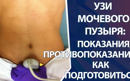 УЗИ мочевого пузыря: как подготовиться к УЗИ мочевого пузыря, показания и противопоказания