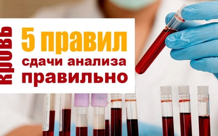 Сдаем биохимический анализ крови без ошибок. 5 правил подготовки