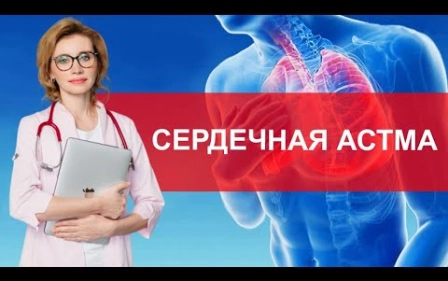 Сердечная астма. Что важно знать?